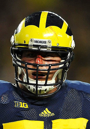 Taylor Lewan (77)