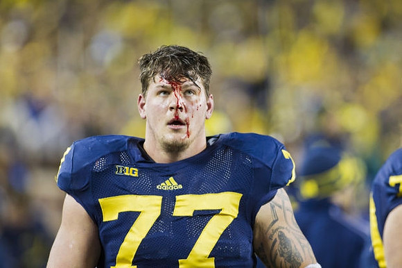 Taylor Lewan (77)
