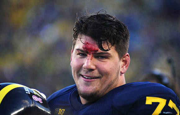 Taylor Lewan (77)