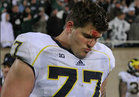 Taylor Lewan (77)