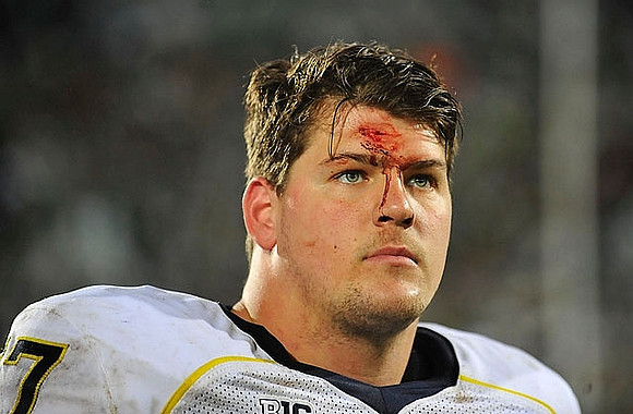 Taylor Lewan (77)